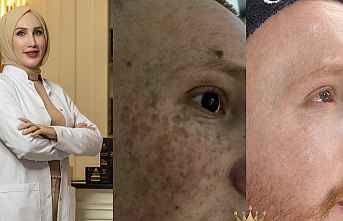 Bebeksi Bakım Nedir? Uzman Estetisyen Özlem Aksünger...