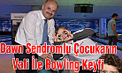 Dawn Sendromlu Çocukarlın Bowling Keyfi